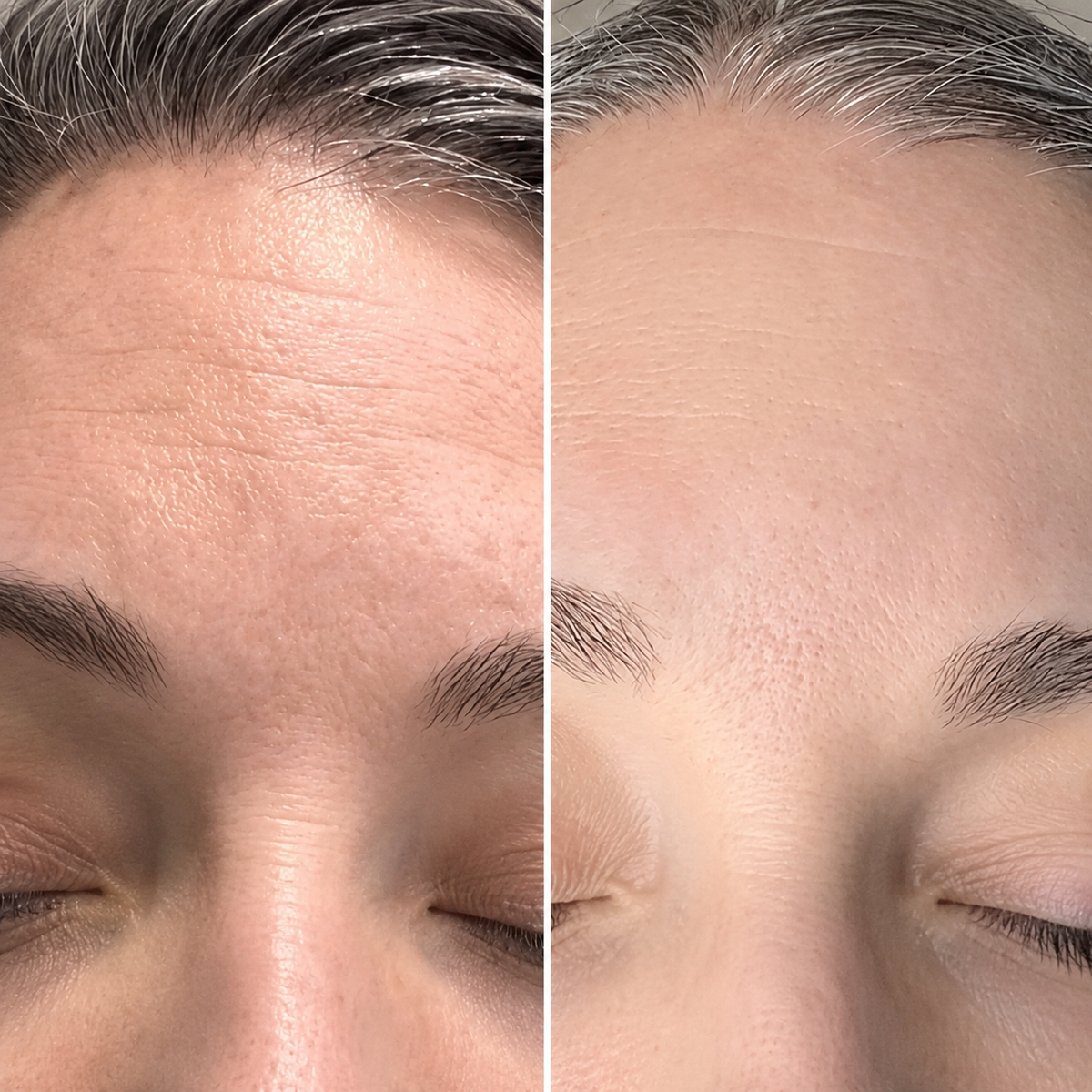 Before and after result