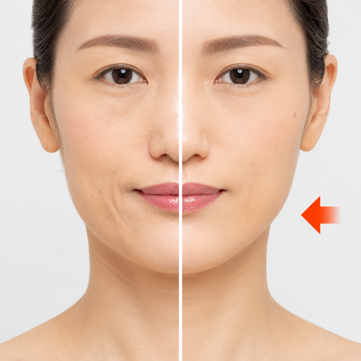 Before and after result