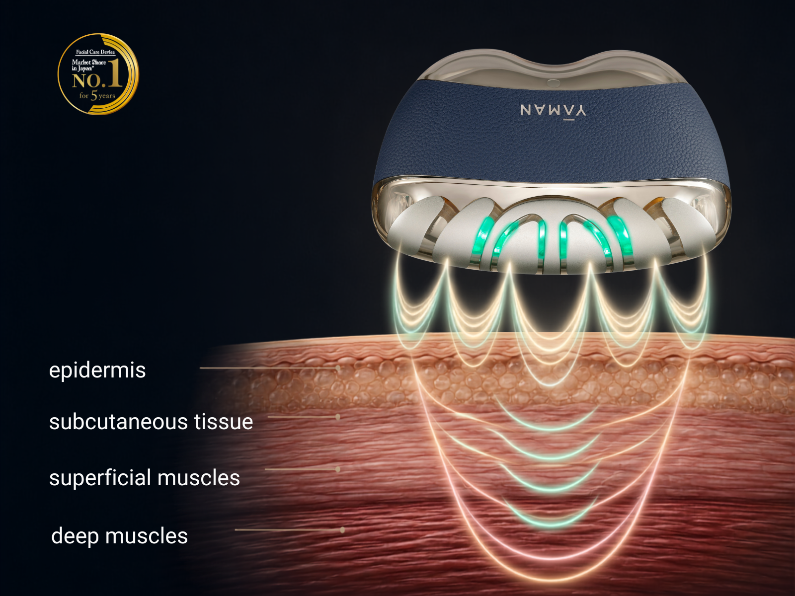 MULTI-FREQUENCY EMS FOR SURFACE-TO-DEPTH CARE